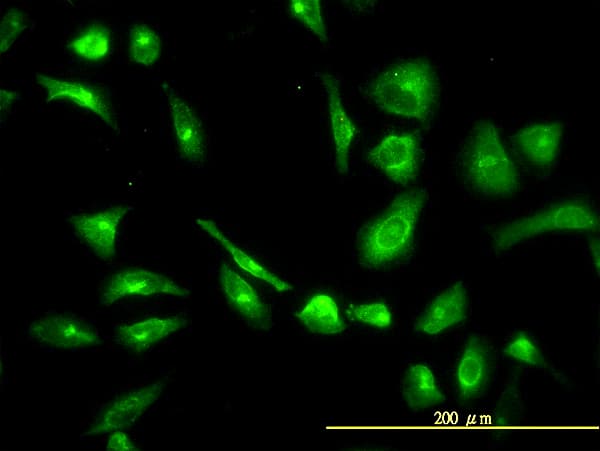 IHC-plus™ Monoclonal Mouse anti-Human CPVL Antibody (clone 2G5-1C1, IHC, IF, WB)