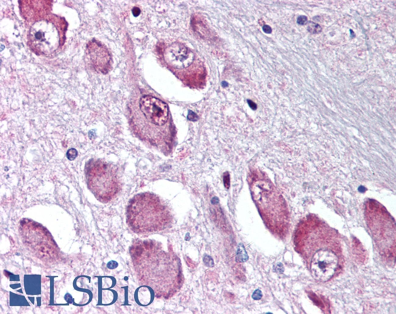 PathPlus™ Polyclonal Rabbit anti-Human GABRA3 Antibody (N-Terminus, IHC)