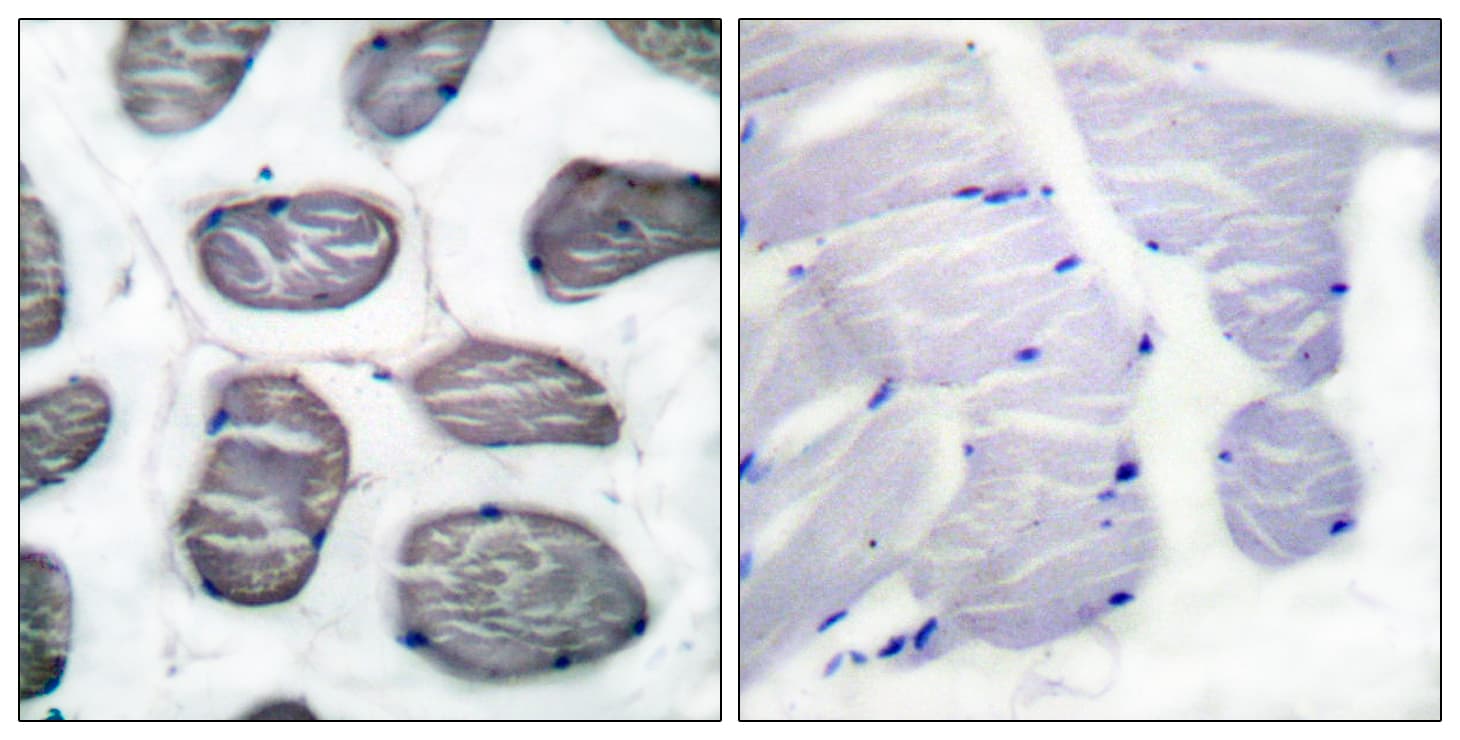 ACTA1 / Skeletal Muscle Actin Antibody (aa1-50)