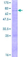 Human ATOH8 Protein (Recombinant GST)
