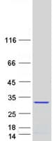Human TNNI3 / Cardiac Troponin I Protein (Recombinant Myc-DDK (Flag))