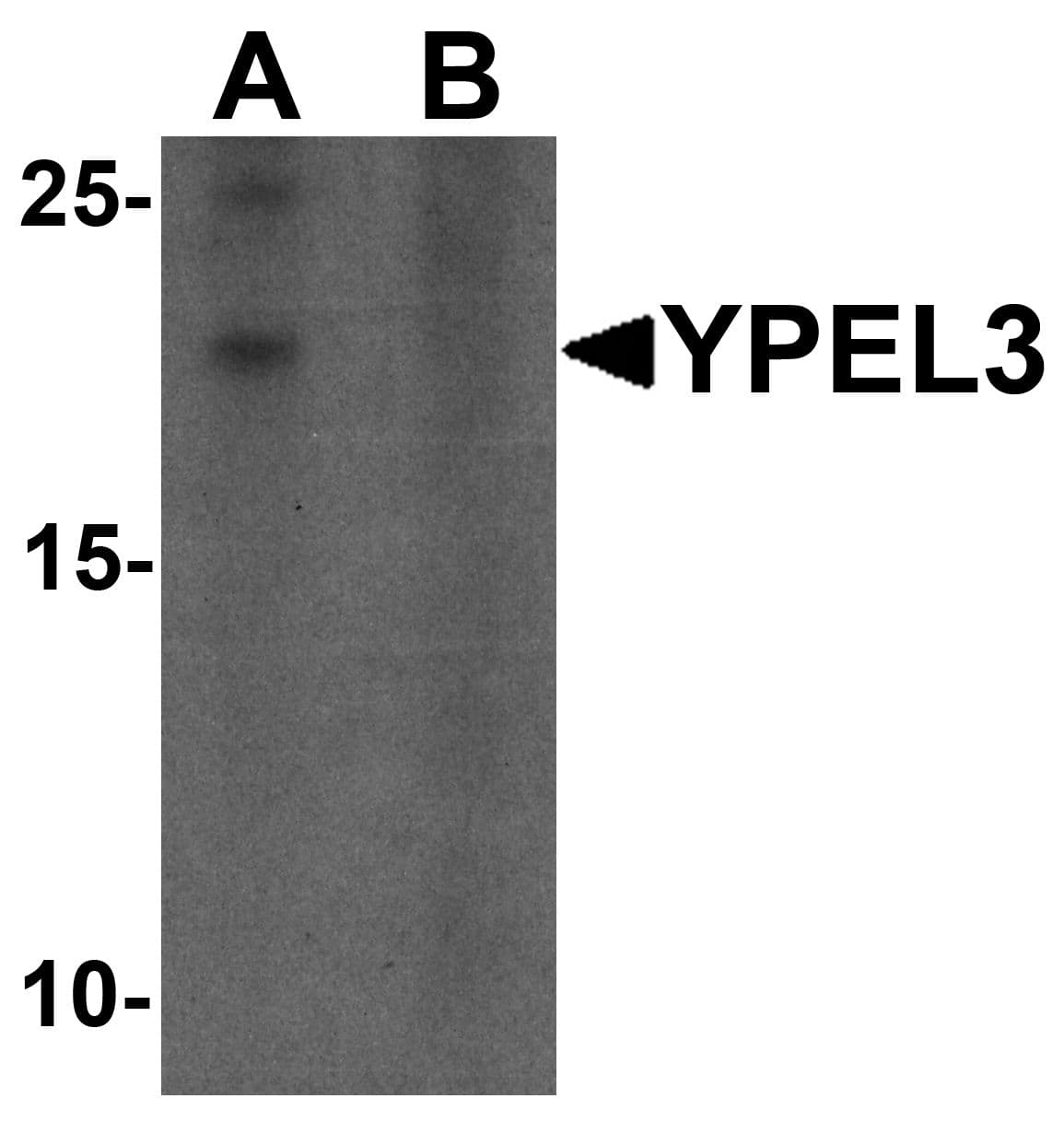 IHC-plus™ YPEL3 Antibody