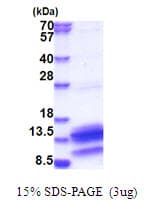 Human PDE6H Protein (Recombinant His)