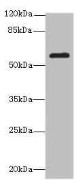 Polyclonal Rabbit anti-Human MMP19 Antibody (IHC, WB)
