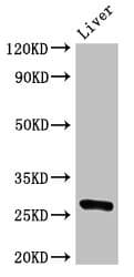 BCL2 / Bcl-2 Antibody