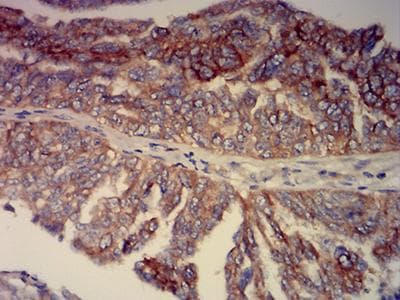 BCAM / CD239 Antibody (clone 8C4E6)