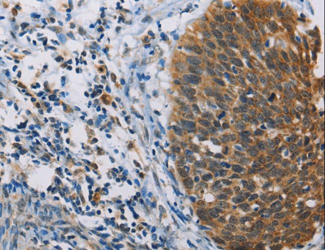 FXYD1 / Phospholemman Antibody