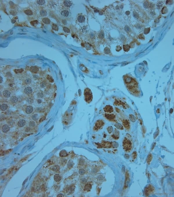 KCNJ13 / KIR7.1 Antibody (aa2-50)