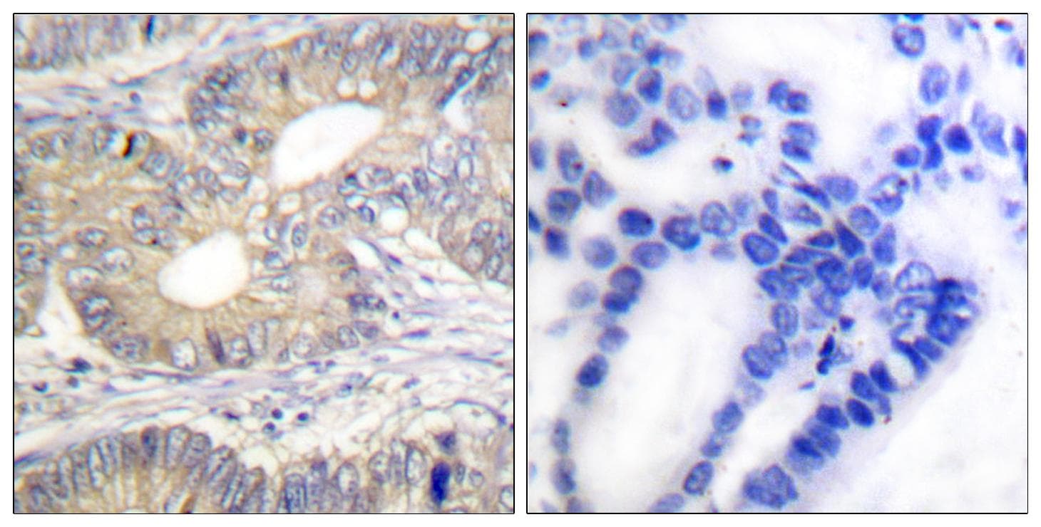 SST / Somatostatin Antibody