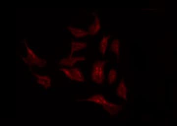 SLC44A1 / CD92 Antibody