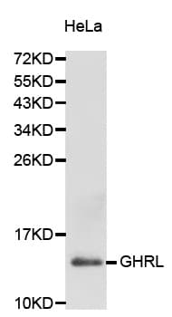 Polyclonal Rabbit anti-Human Ghrelin Antibody (WB)