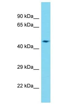 DCAF12L2 Antibody (aa332-381)