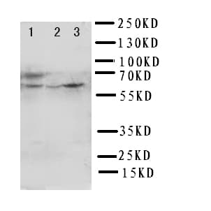 Polyclonal Rabbit anti-Human HEXA Antibody (aa191-207, IHC, WB)