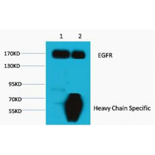 Monoclonal Mouse anti-Human EGFR Antibody (clone M6, WB)