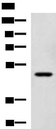 SNIP1 Antibody