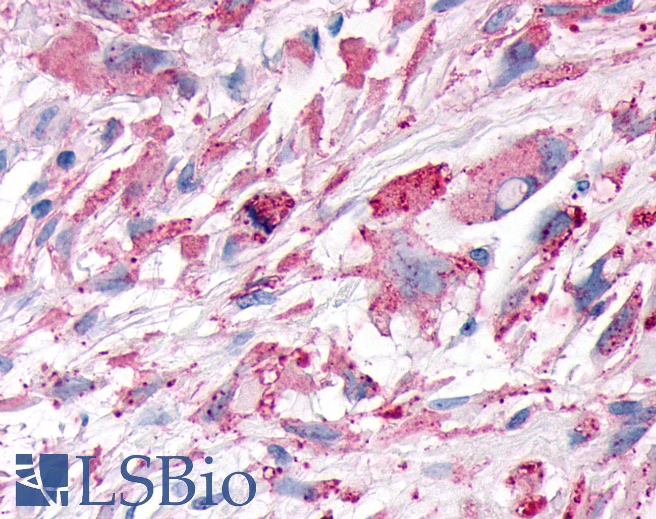 PathPlus™ PKD3 / PRKD3 Antibody (Internal)