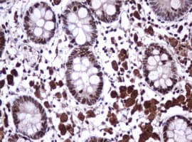 MKI67 / Ki67 Antibody (clone OTI3B8)