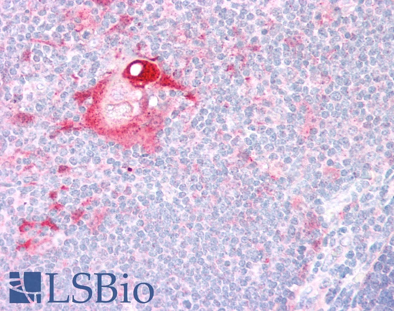 IHC-plus™ ANXA8L1 Antibody