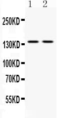 ABL2 Antibody