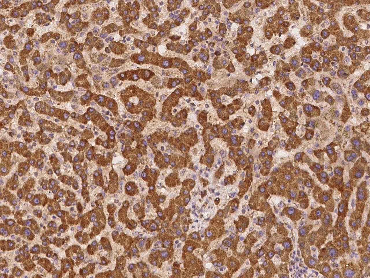 UBXD2 / UBXN4 Antibody