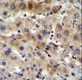 Polyclonal Rabbit anti-Human Apg7 / ATG7 Antibody (aa540-569, IHC, WB)