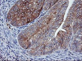 ENPEP / Aminopeptidase A Antibody (clone OTI1E3)
