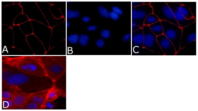 Monoclonal Mouse anti-Human TJP1 / ZO-1 Antibody (clone ZO1-1A12, AF594, aa334-634, IF, WB)