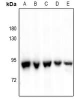ALDH18A1 Antibody