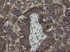 GCP60 / ACBD3 Antibody (clone OTI1G2)