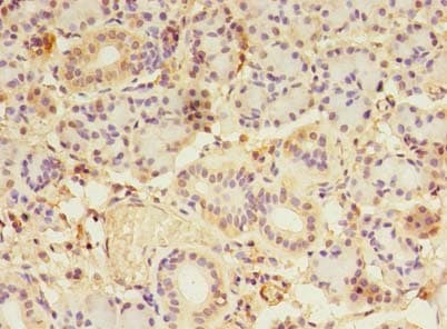 LDAH Antibody