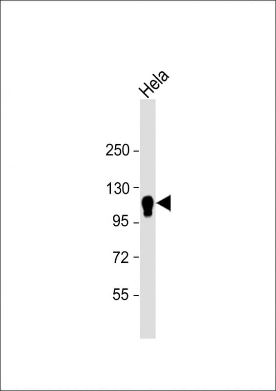 IHC-plus™ CYLD Antibody (clone 1667CT857.3.6.1)