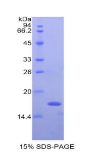Rat IFN Gamma / Interferon Gamma Protein (Recombinant His)