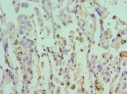 EIF4A1 Antibody (aa167-406)