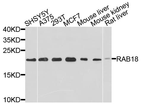 RAB18 Antibody