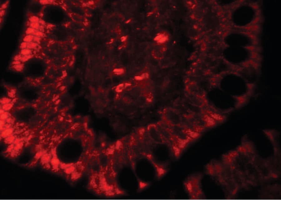Polyclonal Rabbit anti-Human RC3H1 / ROQUIN Antibody (IHC, IF, WB)