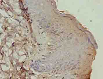 Polyclonal Rabbit anti-Human ATP12A Antibody (aa171-306, IHC)