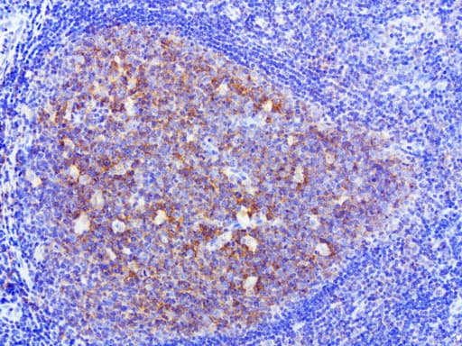 HMBS / PBGD Antibody (clone UMAB144)