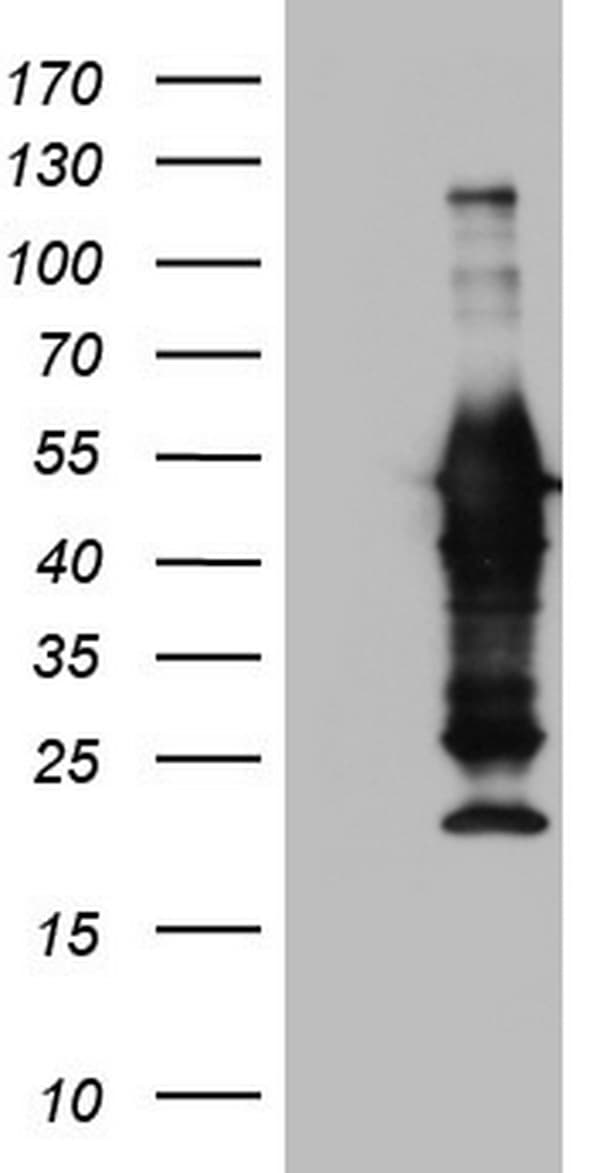 Monoclonal Mouse anti-Human Peripherin Antibody (clone OTI3H1, WB)