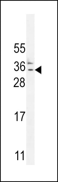 Polyclonal Rabbit anti-Human C11orf73 Antibody (aa6-35, IHC, WB)
