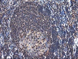 NUDT18 Antibody (clone OTI5F9)