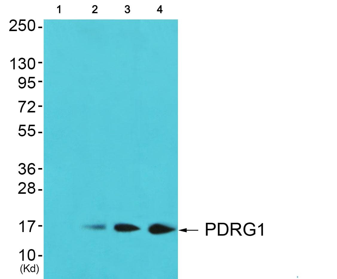 Polyclonal Rabbit anti-Human PDRG1 Antibody (WB)
