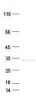 Human CBY3 Protein (Recombinant His, N-Terminal)