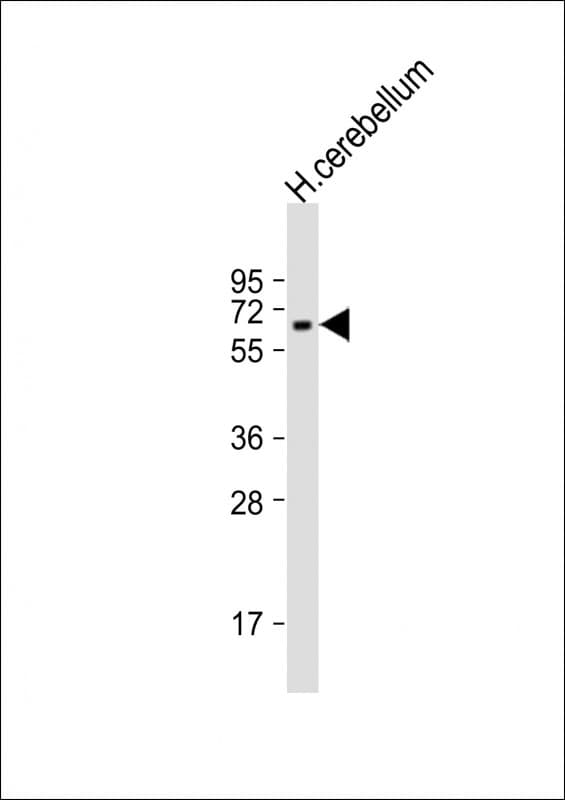 Polyclonal Rabbit anti-Human SPPL2B Antibody (aa196-229, WB)