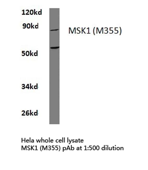 Polyclonal Rabbit anti-Human RPS6KA5 / MSK1 Antibody (Met355, IHC, WB)