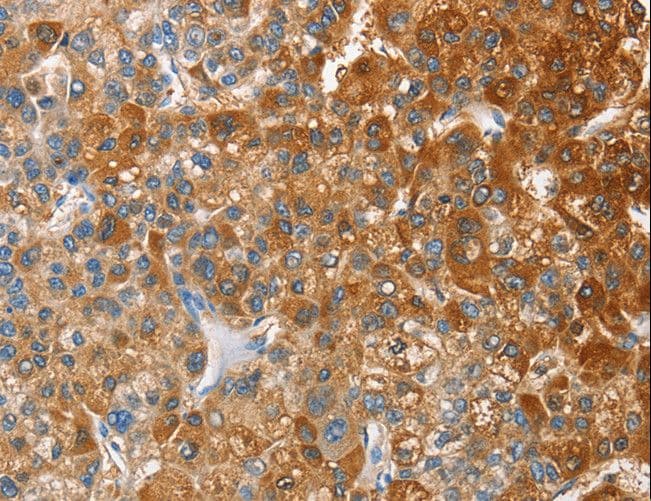 OX2R / Orexin Receptor 2 Antibody