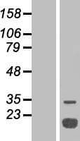 ACP1 / Acid Phosphatase Protein (Over-Expression Lysate Myc-DDK (Flag))