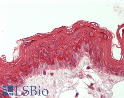 Polyclonal Rabbit anti-Human KRT19 / CK19 / Cytokeratin 19 Antibody (aa251-300, IHC, WB)