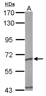 IHC-plus™ Polyclonal Rabbit anti-Human CCT5 / TCP1 Epsilon Antibody (aa89-338, IHC, WB)