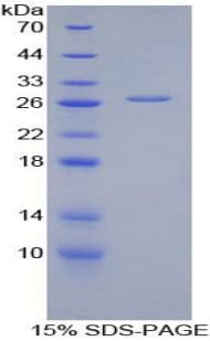 Human GPT / Alanine Transaminase Protein (Recombinant His)