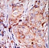 TRB3 / TRIB3 Antibody (aa15-45)